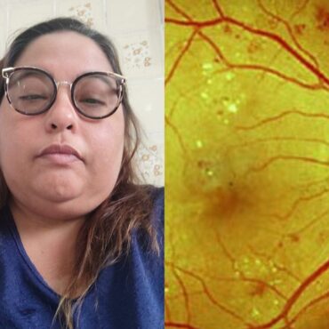 mulher-que-enxerga-vasos-da-retina-sangrando-devido-a-diabetes-luta-por-cirurgia-no-olho-e-teme-perder-a-visao