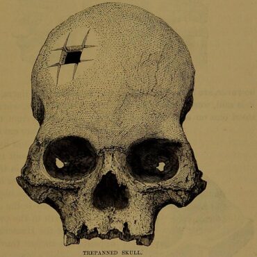 o-cranio-com-perfuracao-quadrada-que-confirmou-que-os-incas-realizavam-cirurgias-complexas