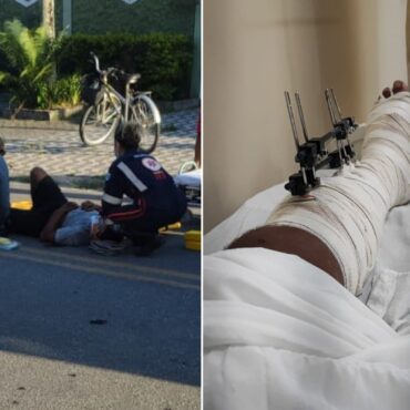 defesa-de-ciclista-atropelado-por-ex-de-prefeito-no-litoral-de-sp-quer-que-ela-responda-por-lesao-dolosa:-‘agiu-com-imprudencia’