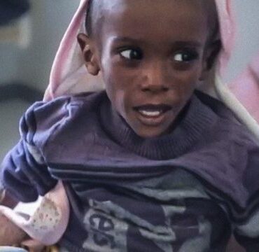fome-na-etiopia:-o-menino-chamado-‘rico’-que-pesa-metade-do-que-deveria