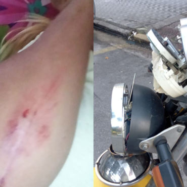 motociclista-sobrevive-ao-ser-atingida-por-carro-desgovernado-em-sp:-‘devia-estar-a-120-km/h’;-video