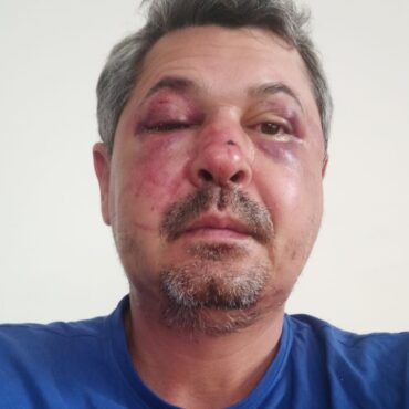 brasileiro-e-espancado-durante-ataque-xenofobico-em-portugal:-‘chutou-minha-cara-e-minhas-costelas’