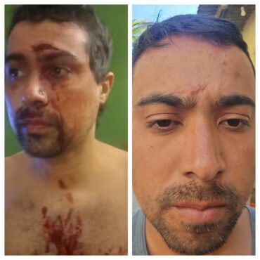 tres-meses-apos-ser-agredido-na-irlanda,-brasileiro-diz-estar-desamparado-pela-policia-local-e-embaixada:-‘me-sinto-impotente’